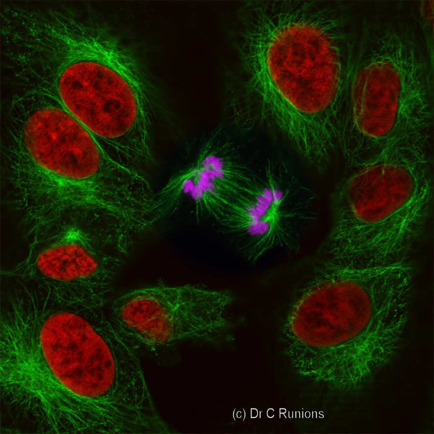 Runions---Anaphase 2